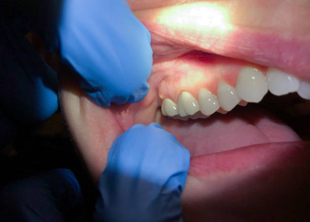 Best Teeth Whitening  in Apple Creek, OH