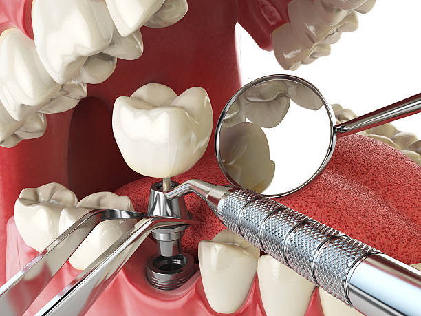 Best Emergency Gum Pain Relief  in Apple Creek, OH