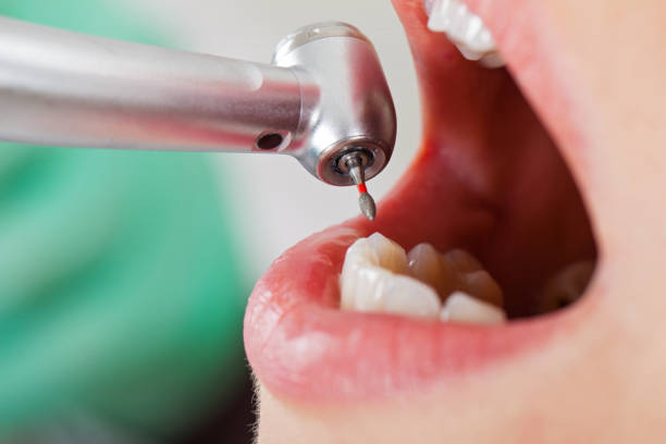 Best Emergency Tooth Extraction  in Apple Creek, OH